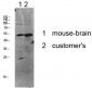 p53 Polyclonal Antibody